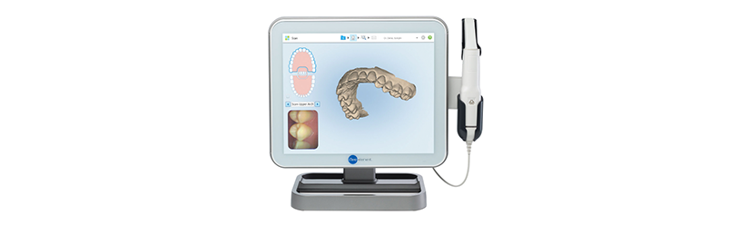 escaner intraoral iTero - ortodoncia invisible Invisalign - Clínica dental Denia Doctoras Gandía