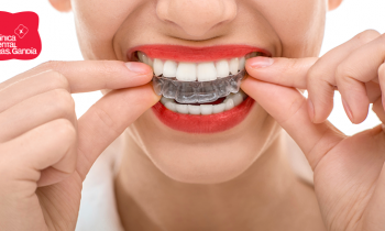invisalign ortodoncia invisible especial diferente - Clínica dental Denia Doctoras Gandía