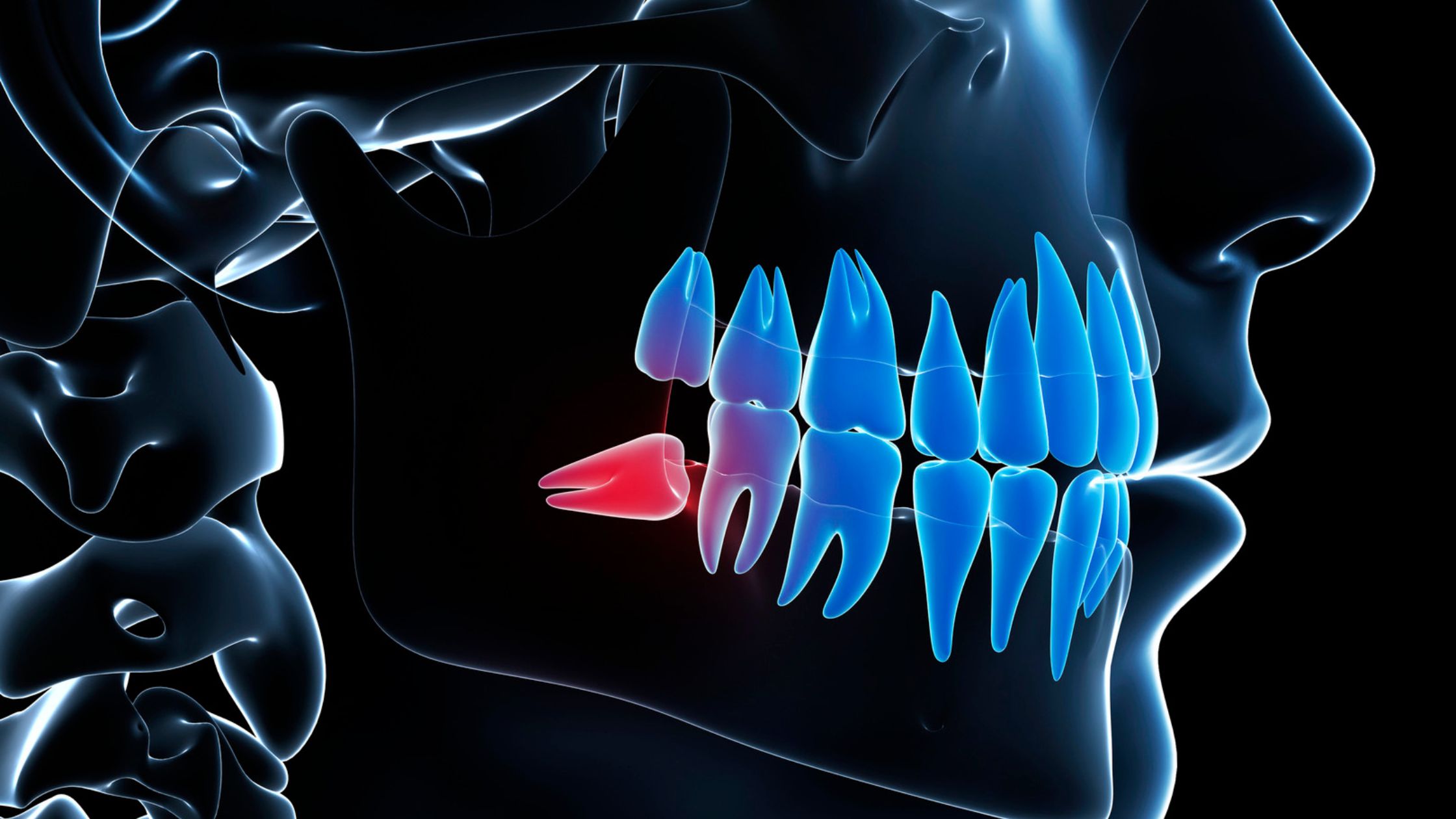 Diente retenido: qué es y cómo tratarlo