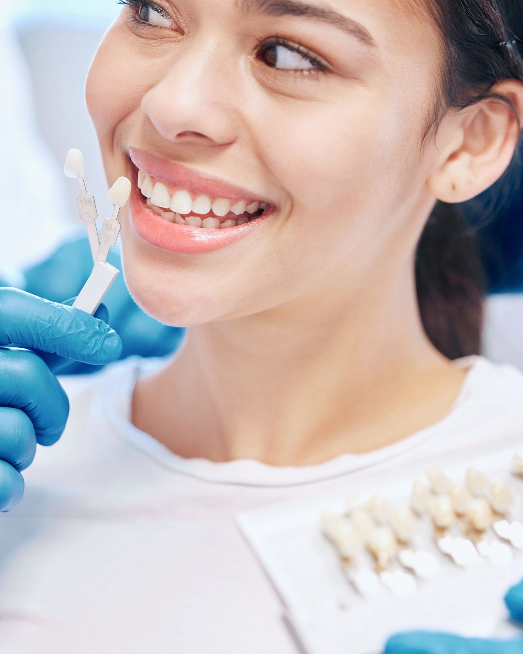 Carillas de porcelana vs. carillas de composite: ¿cuál elegir?